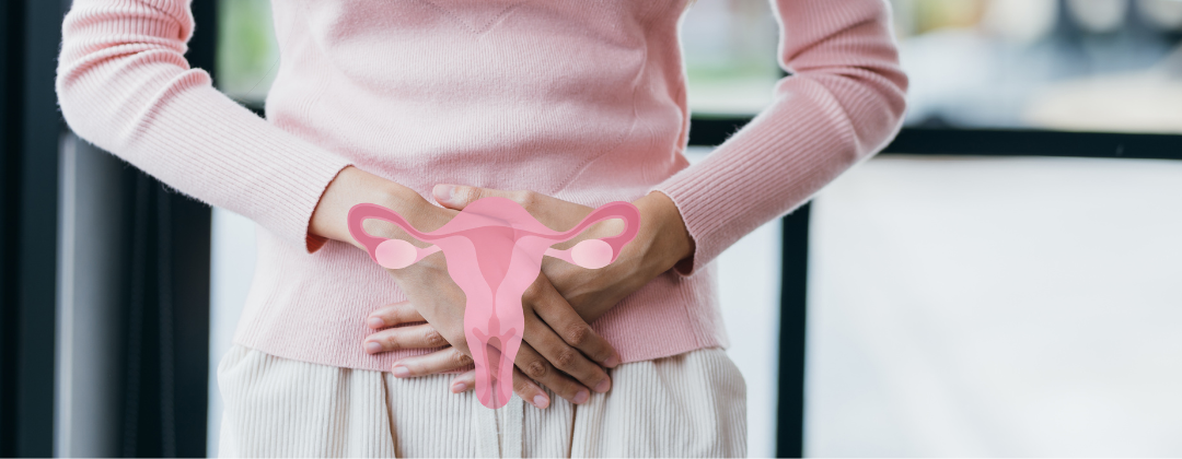 Polycystic Ovary Syndrome (PCOS)