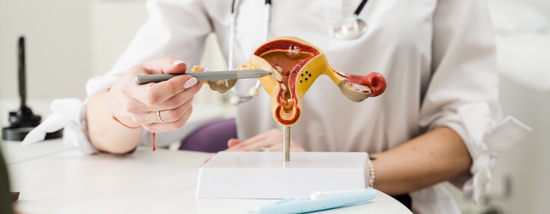 Pelvic Organ Prolapse (Uterine Prolapse)