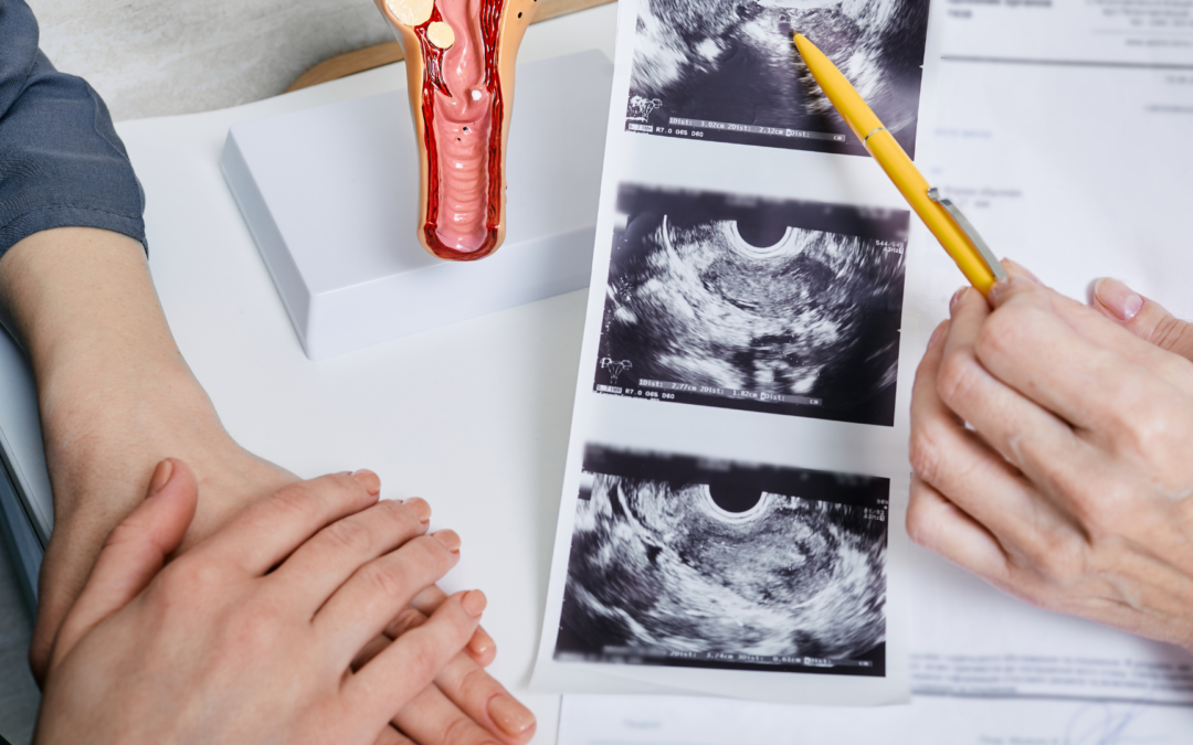 What Is the Endometrium? What Causes Thickening of the Uterine Lining?