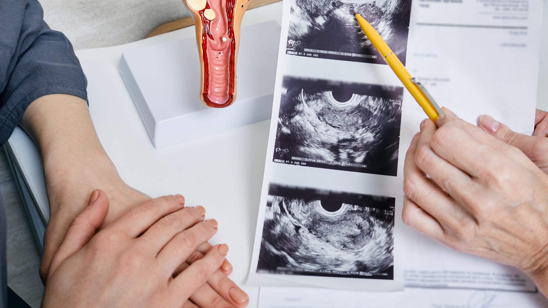 endometrium