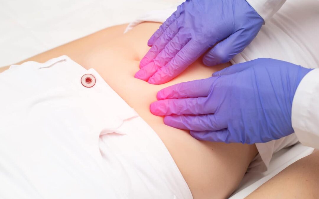 Laparoscopic Ovarian Cyst Surgery